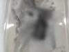 Patay na fetus natagpuan sa condominium sa Tagaytay
