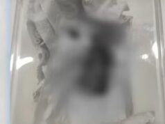 Patay na fetus natagpuan sa condominium sa Tagaytay