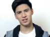 Albie, game makipagplastikan basta’t may bayad!