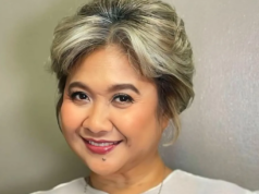 Uge, aminadong nagpa-botox!
