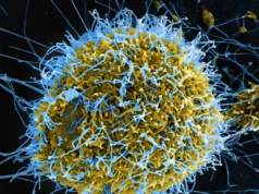 Kaso ng Ebola sa Congo umakyat sa 515