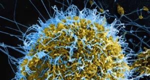 Kaso ng Ebola sa Congo umakyat sa 515