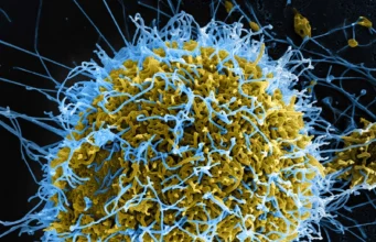 Kaso ng Ebola sa Congo umakyat sa 515
