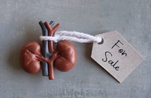 SocMed post ng pagbebenta ng kidney para sa mga concert tix, ikinabahala ng mga doktor