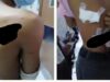 2 stude tinarakan sa rambulan ng mga kabataan sa Davao City