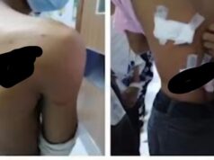 2 stude tinarakan sa rambulan ng mga kabataan sa Davao City