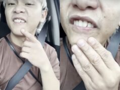 Buboy, napuruhan ang ngipin sa turon!