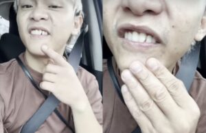 Buboy, napuruhan ang ngipin sa turon!